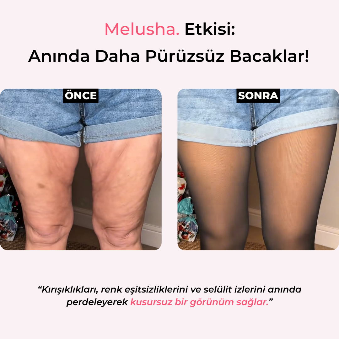 Ten Görünümlü İçi Polarlı Termal Külotlu Çorap